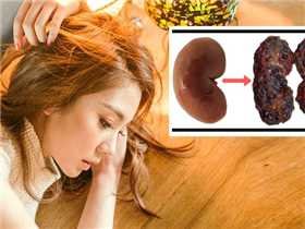 Đừng để vào viện vì 8 thói quen hỏng thận hại thân như thế này 10 280x210 bestie suy than 2 20170517102304