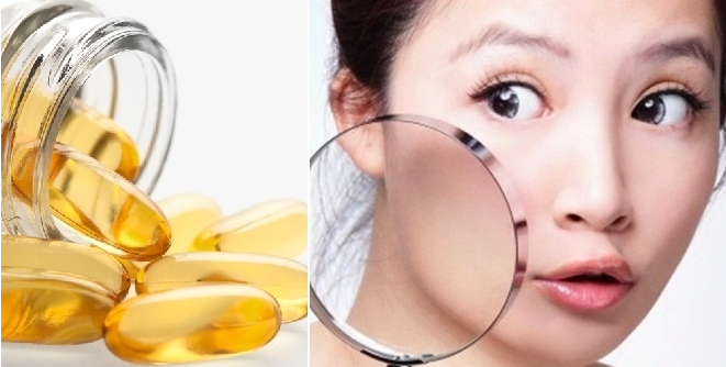 Không cần đến viện thẩm mỹ, 5 mẹo dưới đây cũng lấp đầy sẹo rỗ đến 90% 7 Untitled 1